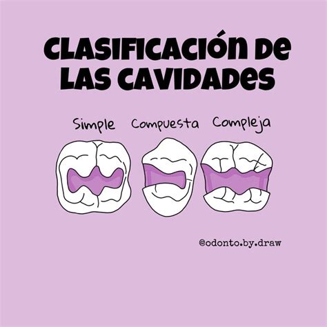 Clasificaci N De Las Cavidades Dentales Escuela De Higiene Dental