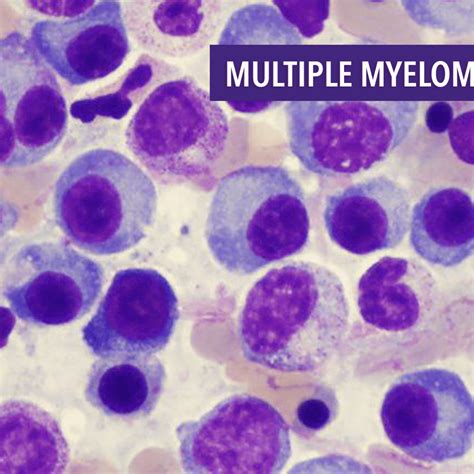 How Long Do Dogs Live With Multiple Myeloma