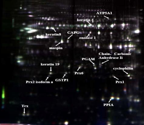 A Representative 2d Dige Image Of The Whole Lysate Of Hacat Cells Download Scientific Diagram