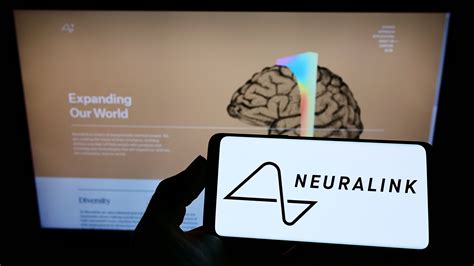 Implante Cerebral De Neuralink Falla Detectan Problemas En El Hombre Al Que Le Pusieron Chip