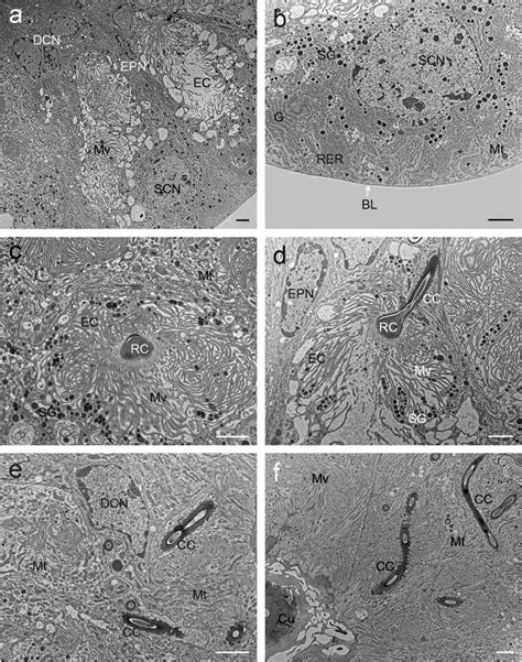 Tem Micrographs Of The Spermathecal Duct Of Sinopanorpa Tincta A