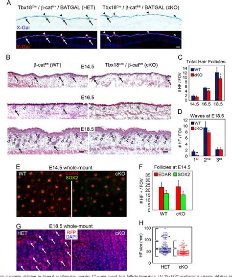 Wnt Catenin Signaling In Dermal Condensates Is Required For Hair