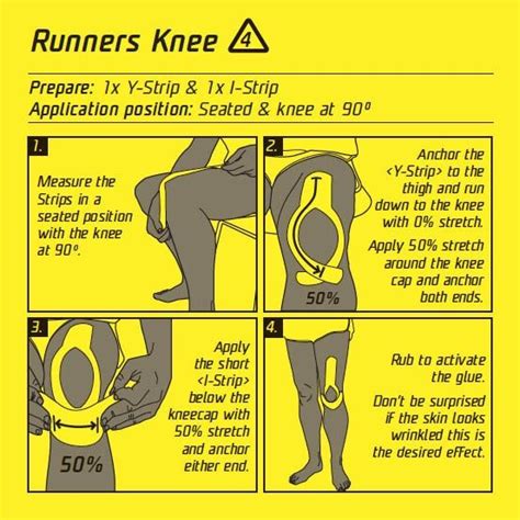 This is one of the taping techniques i use on a constant basis. Runner ...