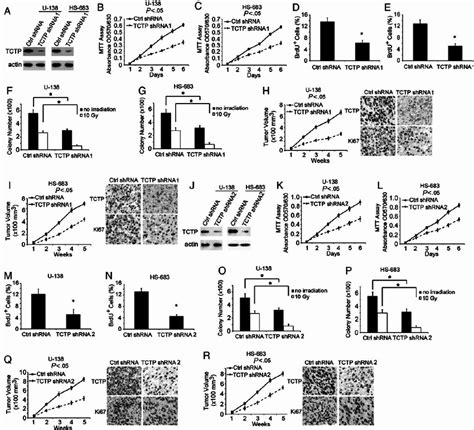 TCTP Knockdown Inhibits Glioma Cell Proliferation In Vitro And In Vivo