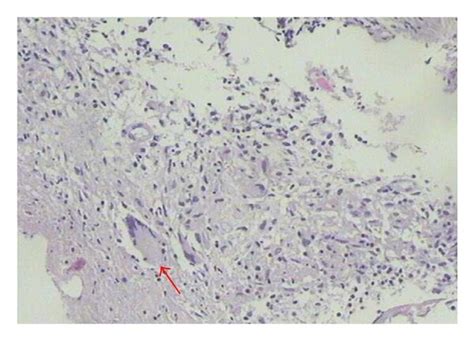 Abdominal Ct Ultrasonography And Cytohistological Features On Download Scientific Diagram