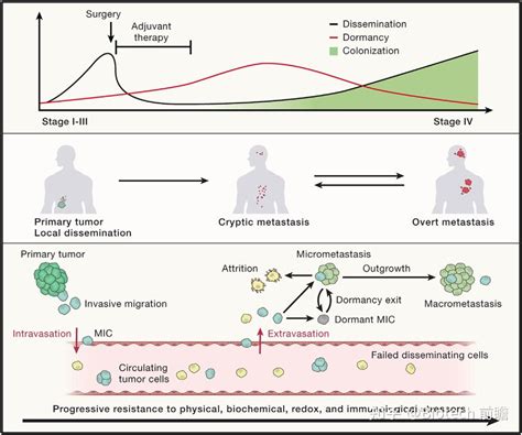 Cell丨肿瘤转移的主要机制及治疗机会点 知乎