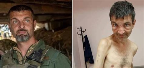 Las Fotos Del Antes Y El Despu S De Un Soldado Ucraniano Liberado Que