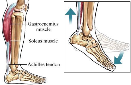 Achilles Pain - Experts in Achilles pain with Advanced Treatment