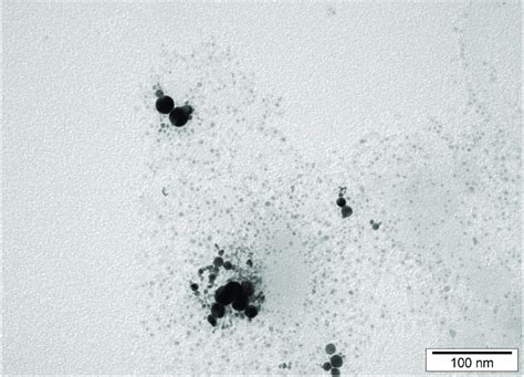 Transmission Electron Microscopic Images Of Platinum Nanoparticles Bar