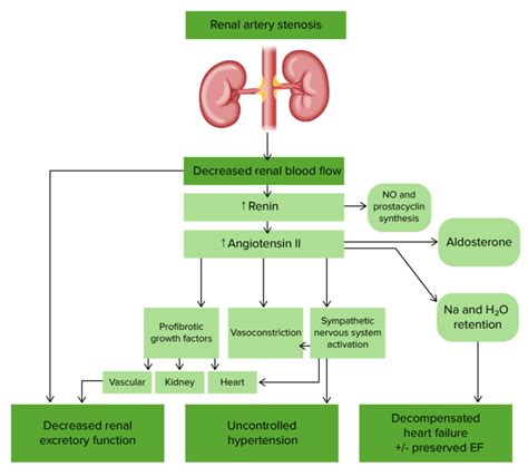 Renal Artery Stenosis Concise Medical Knowledge