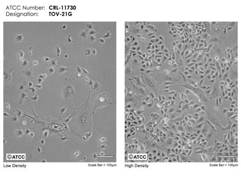 TOV 21G细胞ATCC CRL 11730细胞 TOV21G人卵巢癌细胞株购买价格培养基培养条件细胞图片特征等基本信息 生物风