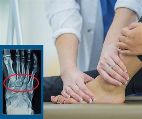 Treating Trauma To The Foot Lis Franc Injuries Ocean County Foot