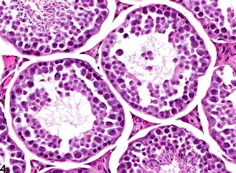 Testis Germinal Epithelium Degeneration Nonneoplastic Lesion Atlas