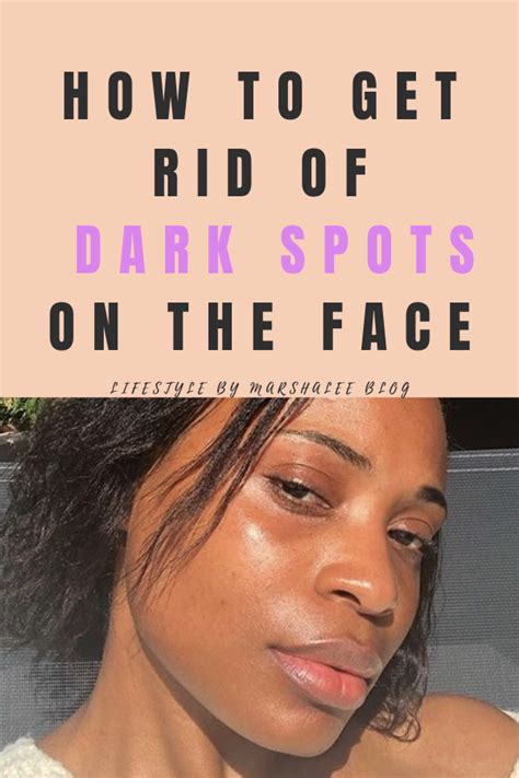 Get Rid Dark Spots On Your Face And Body Artofit