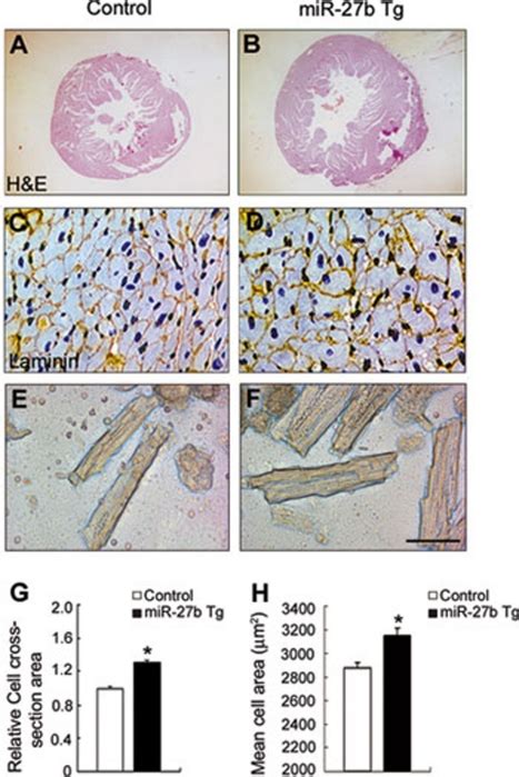 Overexpression Of Mir 27b In Vivo Induced Cardiac Hypertrophy A B