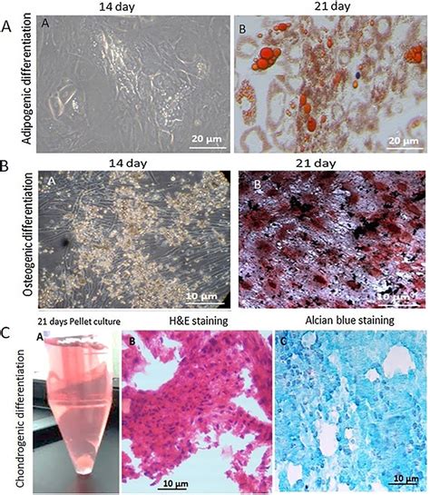 Trilineage Differentiation Potential Of Human Adipose Tissue Derived