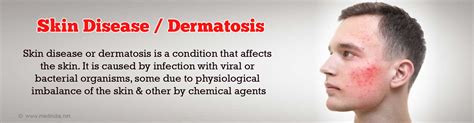 Skin Disease Dermatology Disorder Problems Cancer Pigmentation