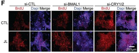 Plos Biol：昼夜节律紊乱促进肿瘤生长 癌症研究专区 生物谷