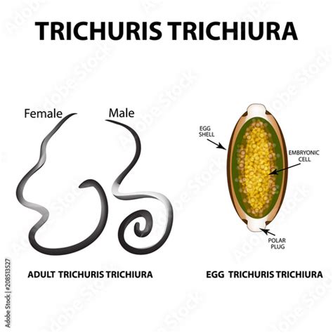 Trichuris Life Cycle