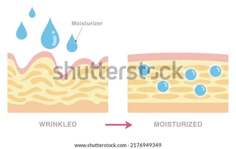 Stock Vektor „cross Section Wrinkled Skin Moisturized Skin“ Bez