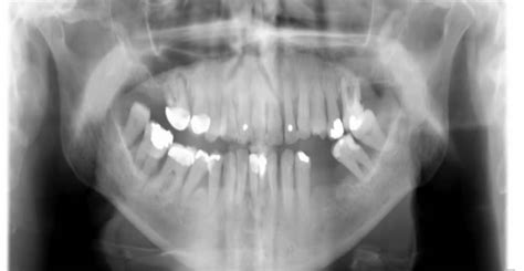 Dental Before And After Cases Elmfield House Dental Practice Middlesex