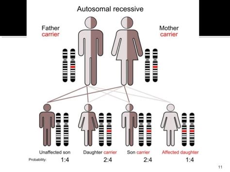 Albinism