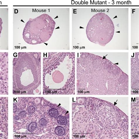 Double Mutant Ovary Luteinized Like Cells Express 3 ␤ Hsd A Control