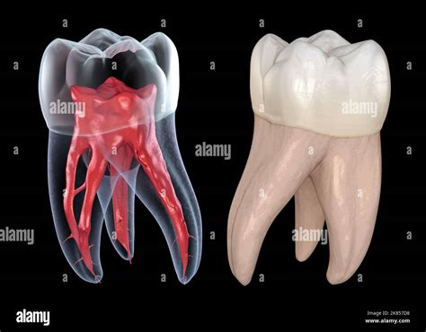 Anatomía de la raíz dental - primer diente molar maxilar. Ilustración ...