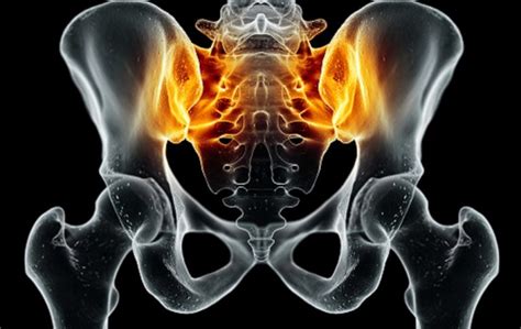 Sacroiliac Joint Inflammation