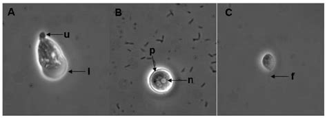 Morphological Characteristics Of Cres3b Isolate Of Naegleria Download Scientific Diagram