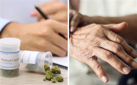 Científicos desarrollan fármaco a base de marihuana contra Parkinson