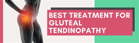 Best Treatment For Gluteal Tendinopathy Trochanteric 44 OFF