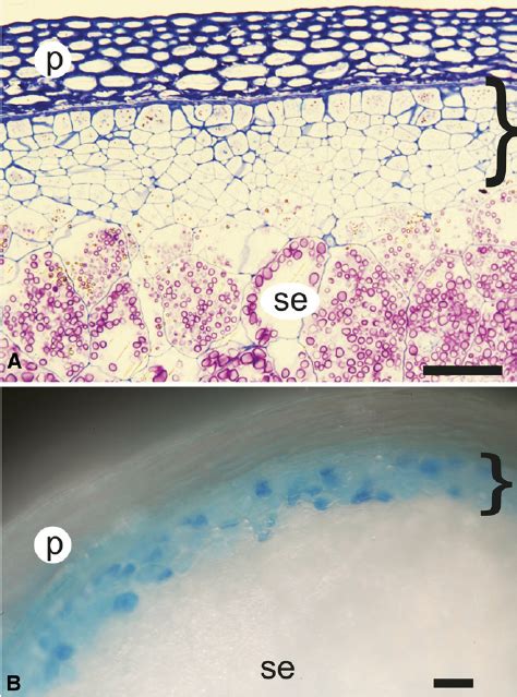 Double Mutant Analysis Between Nkd And Thk A Histo Logically