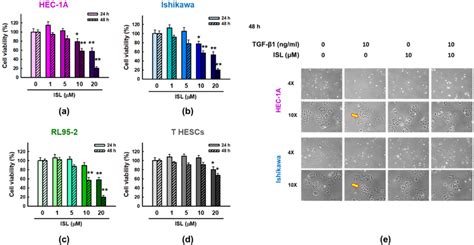 Figure 1 From Isoliquiritigenin Reverses Epithelial Mesenchymal