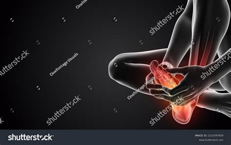 Foot Neuropathy Over 271 Royalty Free Licensable Stock Illustrations And Drawings Shutterstock