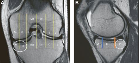 Yale Department Of Orthopaedics And Rehabilitation On Twitter