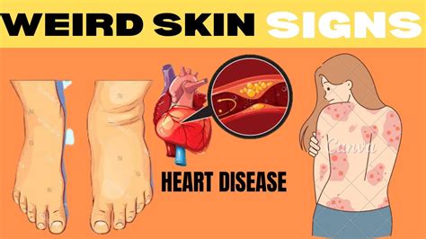 Hidden Dangers 12 Unusual Signs Of Heart Disease Youtube