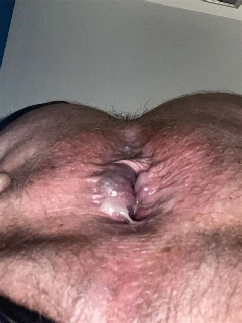 Horny Ass Pussy Pics XHamster