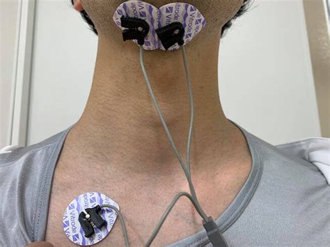 Placement Of The Electrodes For Surface Electromyography Measurement