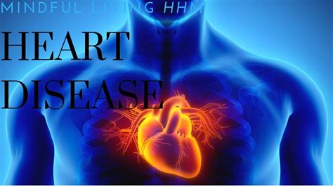 Heart Disease Prevention Reduce Your Risk Youtube