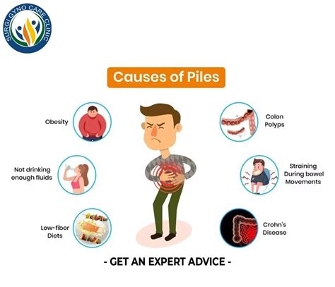 Causes of Piles - Best Piles Treatment in Agra