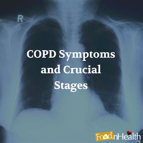 What Are the COPD Symptoms and Crucial Stages - Food N Health