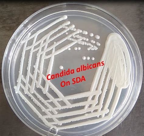 Candida Albicans Microscopic Morphology