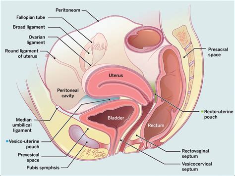 Peritoneal Cavity Uterus