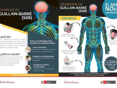 Síndrome de Guillain Barré la enfermedad que paralizó a un país qué