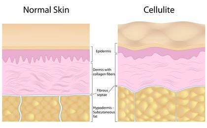 Connective Tissue - Biology Encyclopedia - cells, body, function, human ...