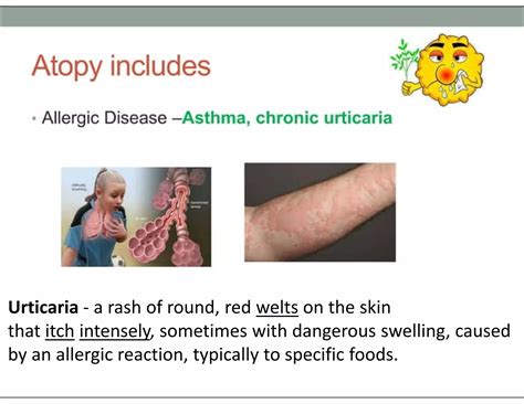 Maternal prenatal and genetic influences on development of defect and