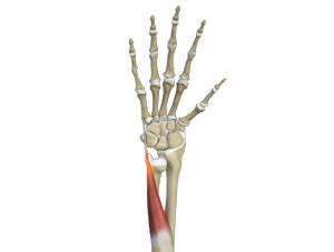 Ecu Tendinopathy