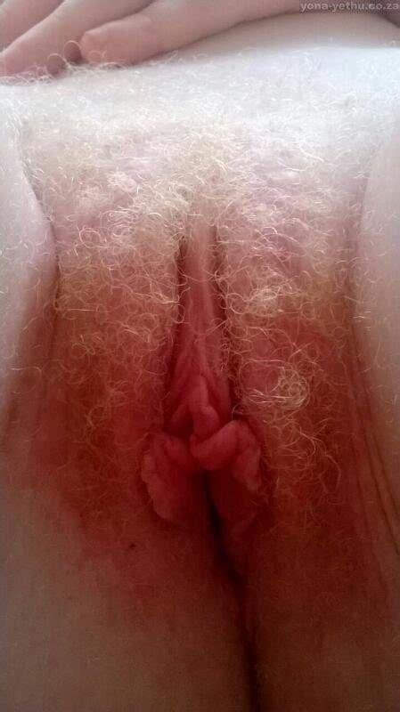 Pretty Hairy Albino Pussy Yona Yethu Co Za Yona Yethu South