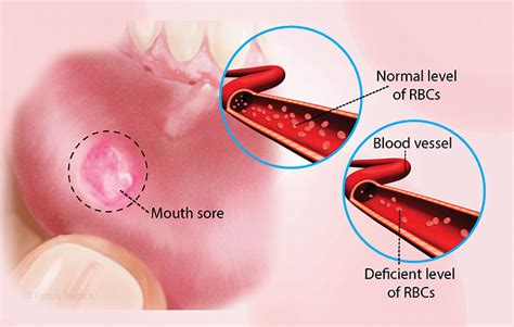 Health Condition : Symptoms, Causes, Treatment and More